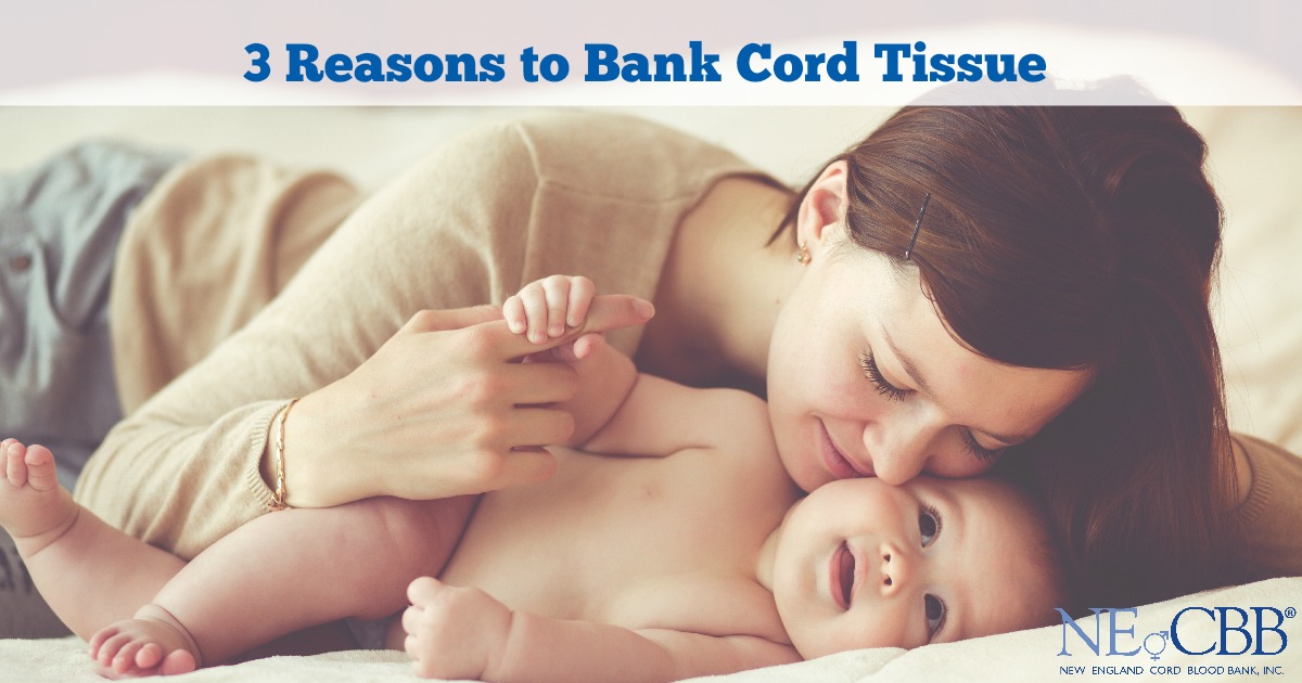 banking cord tissue