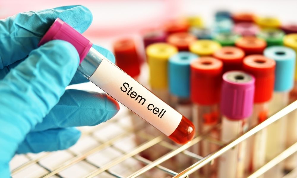 Reasons To Consider Storing Cord Blood