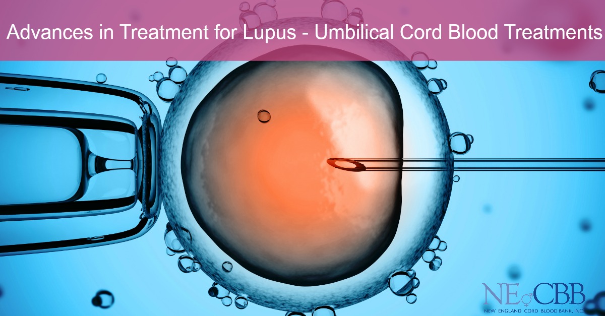 Lupus Treatment Cord Blood Stem Cells