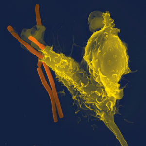 Neutrophil with Anthrax